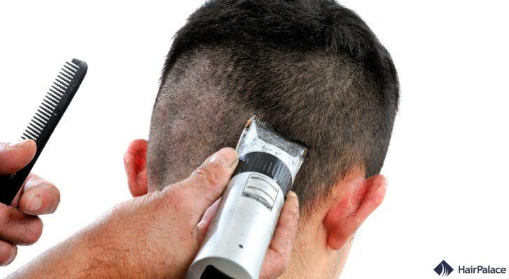 coupe de cheveux avant la implant capillaire