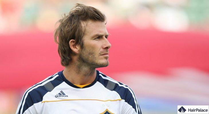 greffe de cheveux david beckham