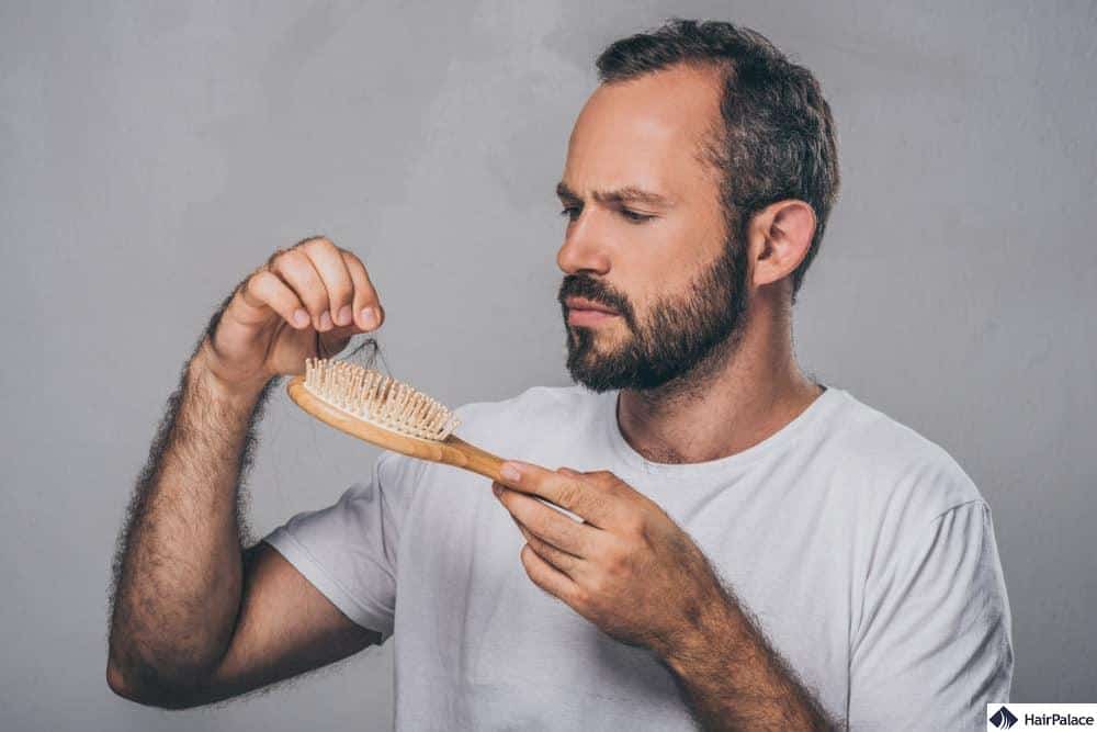 La calvitie masculine, un marché lucra'tif sans en avoir l'hair