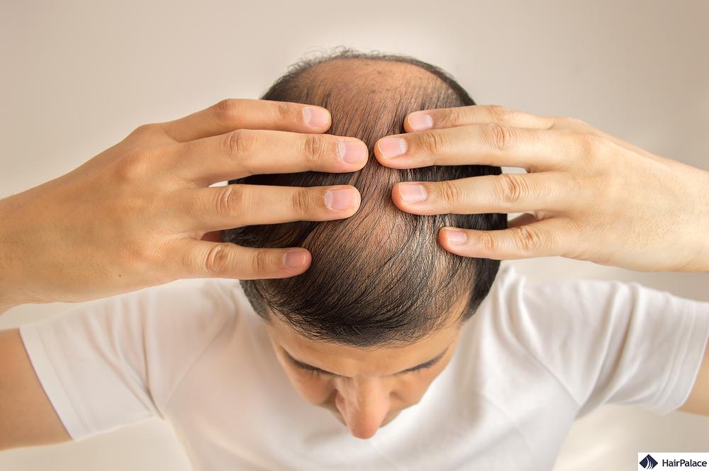 remède contre la chute de cheveux