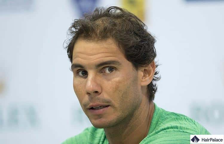 perte de cheveux rafael nadal