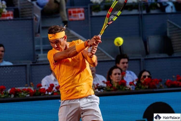 Rafael Nadal greffe de cheveux