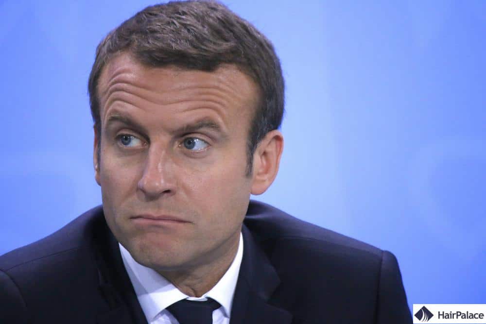Emmanuel Macron implant capillaire