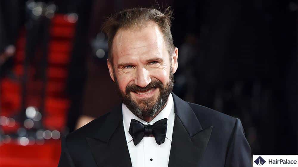 Ralph Fiennes calvitie masculine