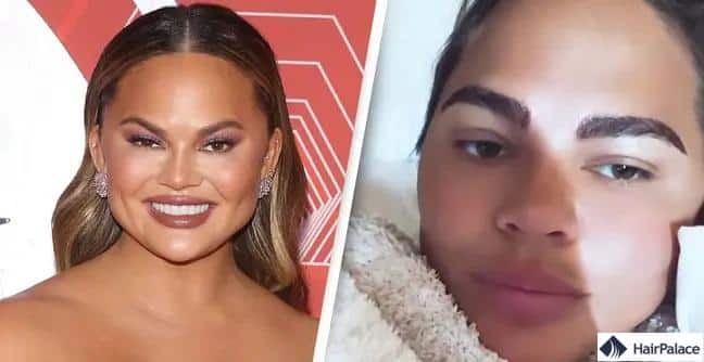 Chrissy Teigen avant et après sa greffe de sourcils