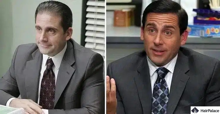 Greffe de cheveux Steve Carell avant et après