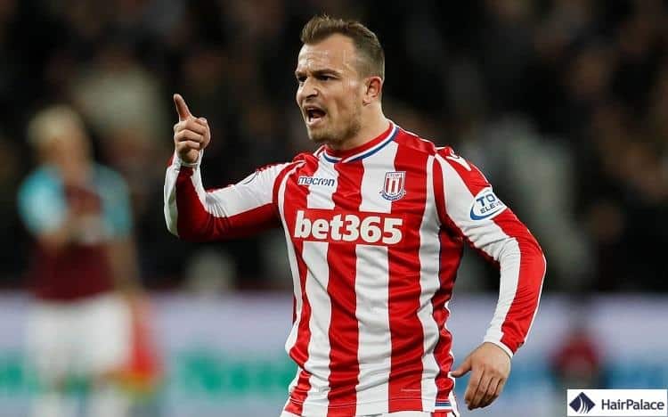 La perte de cheveux de Xherdan Shaqiri n'a fait qu'empirer avec le temps