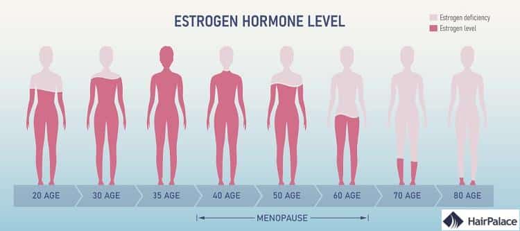 de faibles niveaux d'œstrogène peuvent entraîner une perte de cheveux hormonale