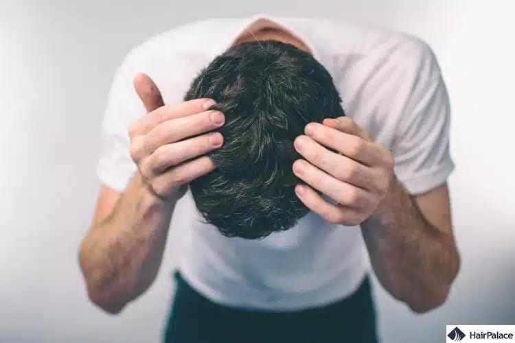 les pellicules peuvent provoquer la chute des cheveux