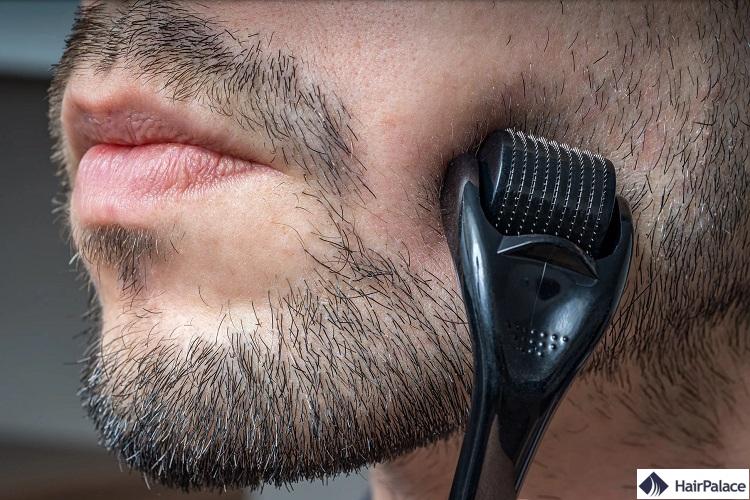 derma roller pour la pousse de la barbe