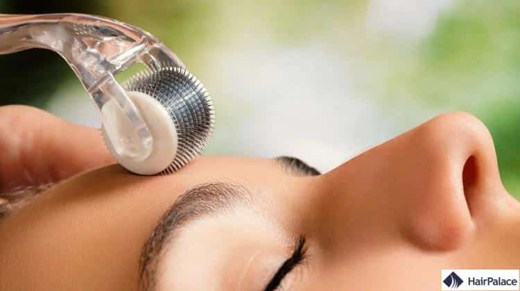 derma roller pour le réjuvénation des cheveux et de la peau