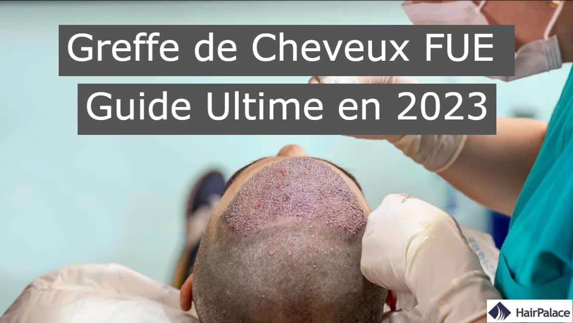 Greffe de cheveux FUE guide ultime en 2023