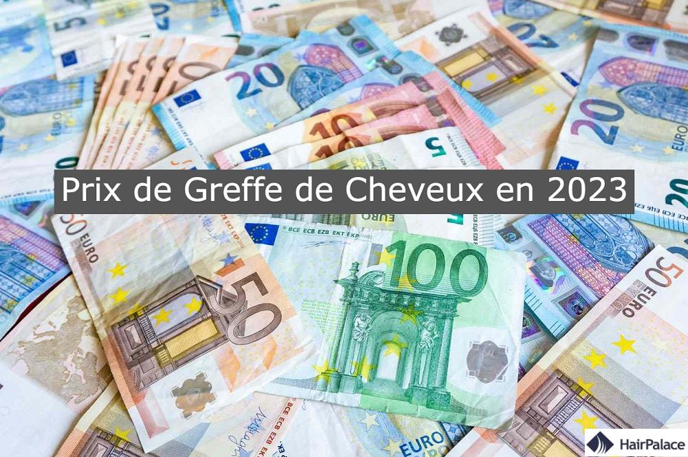 Prix de greffe de cheveux