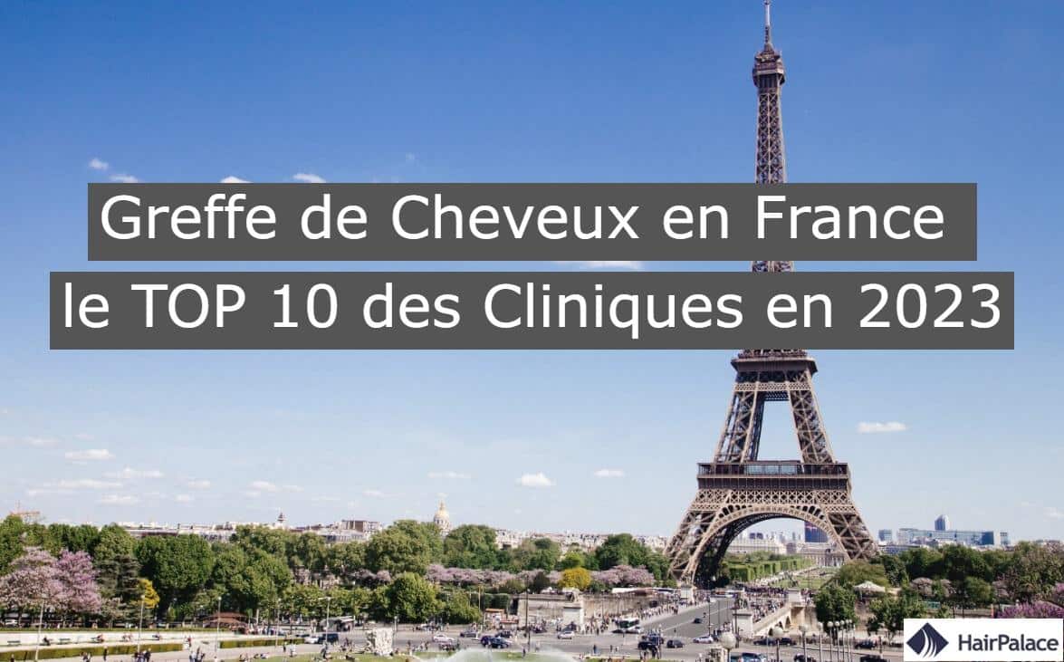 Greffe de Cheveux en France le TOP 10 des cliniques en 2023