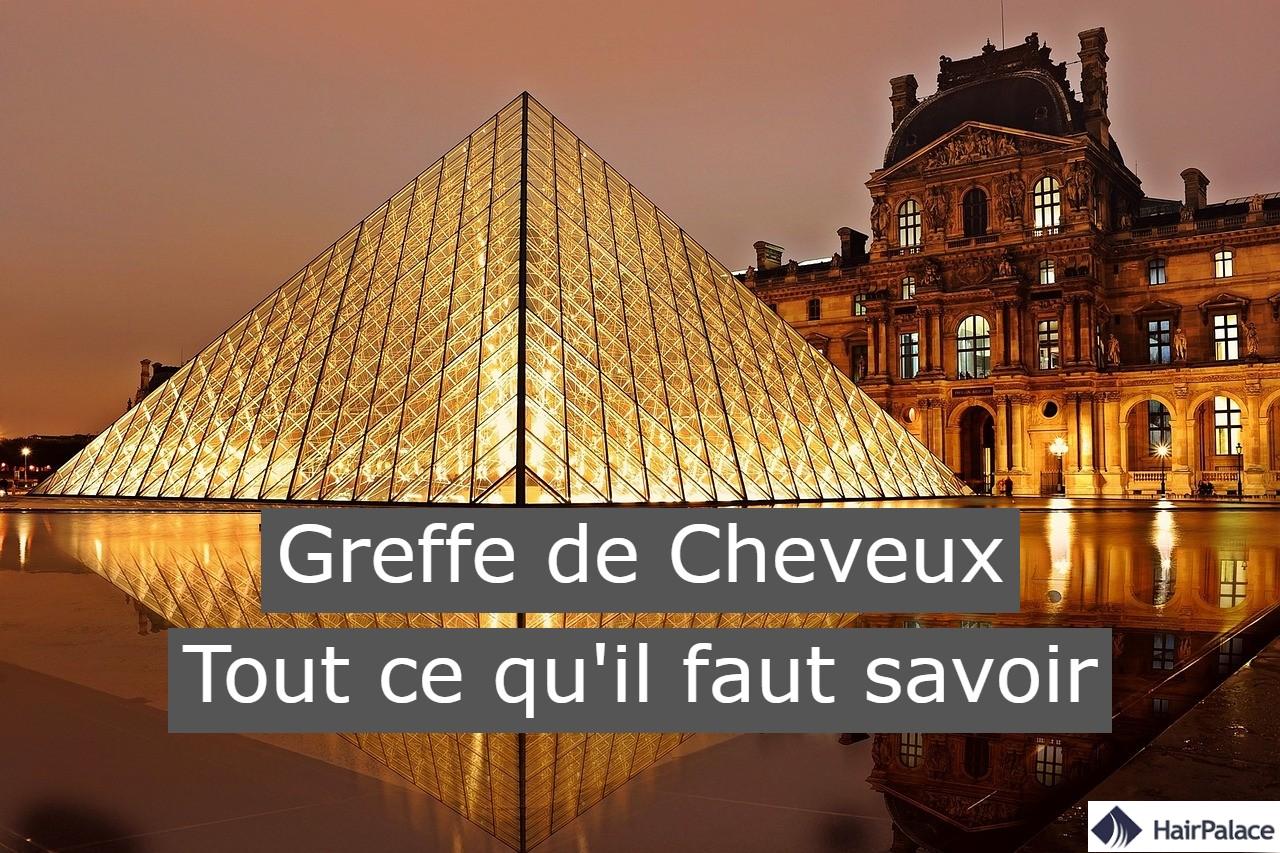 Greffe de cheveux tout ce quil faut savoir