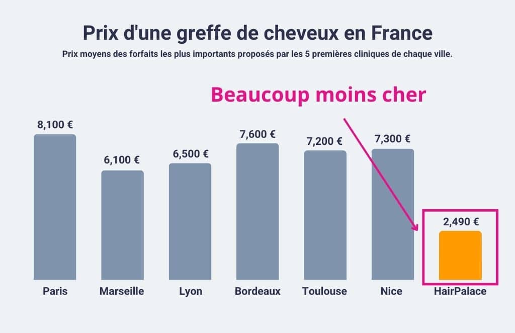 Prix moyens d'une greffe de cheveux FUE en France