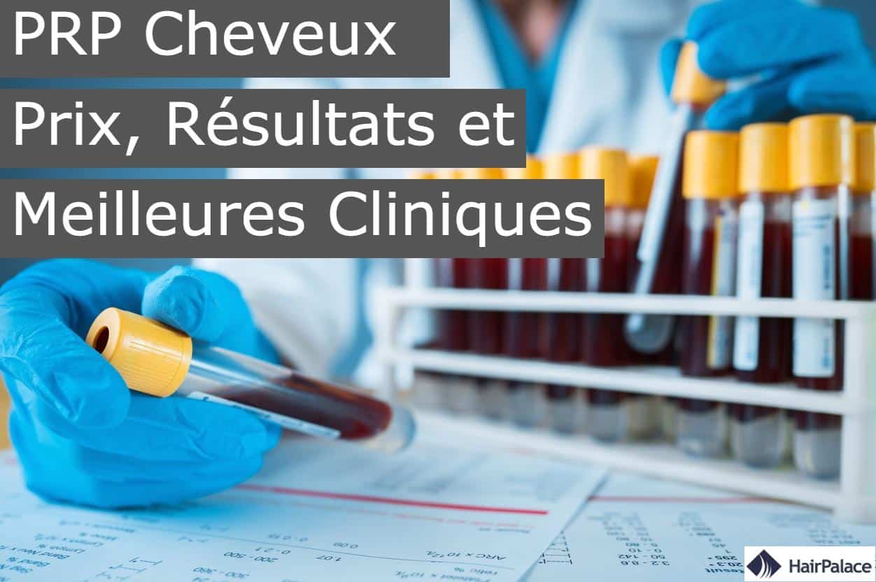 prp cheveux prix resultats et meilleures cliniques