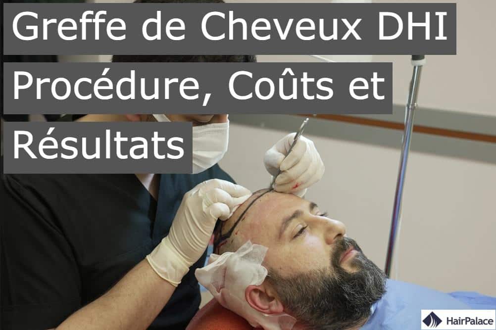 greffe de cheveux DHI procedure couts et resultats