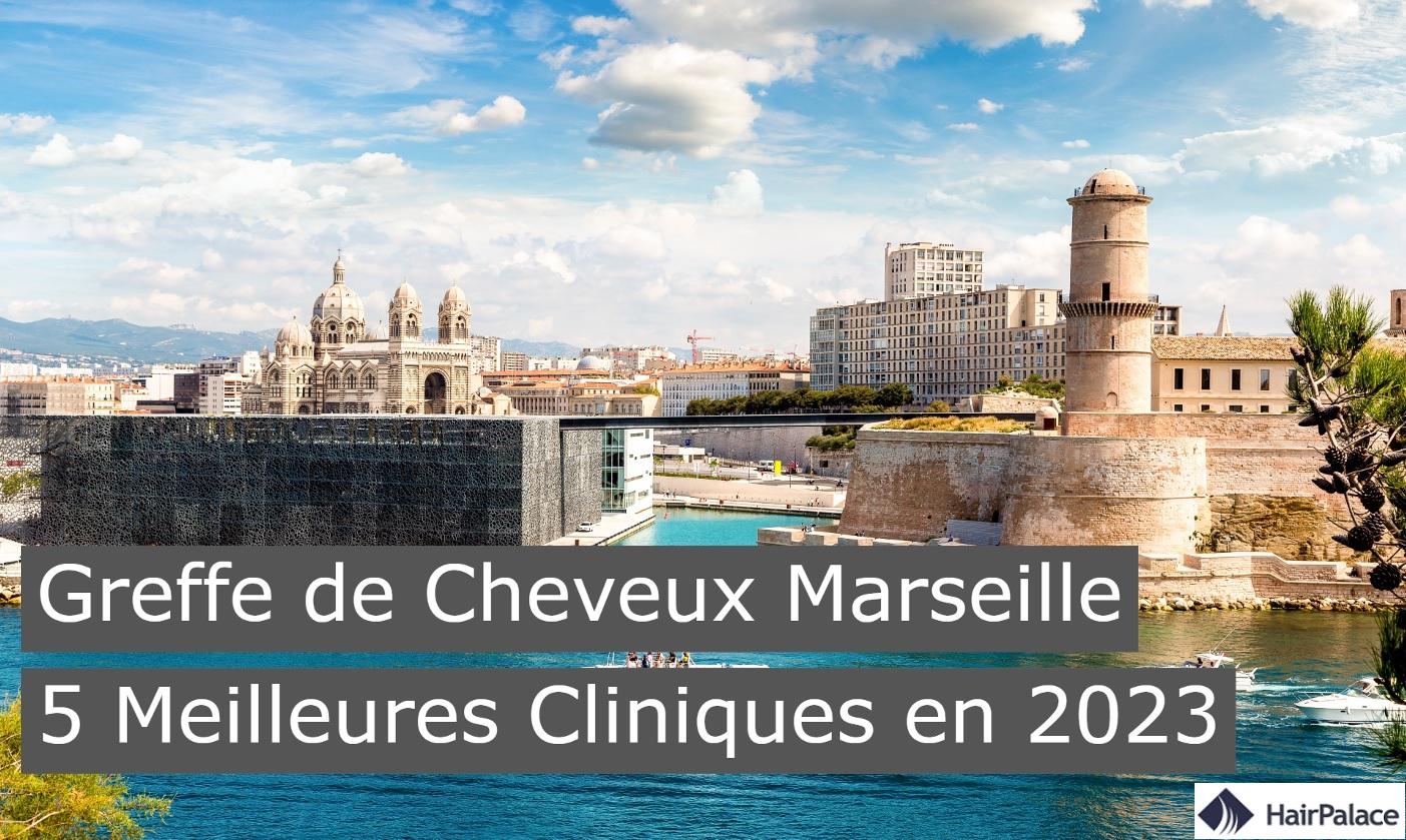 greffe de cheveux marseille 5 meilleures cliniques en 2023