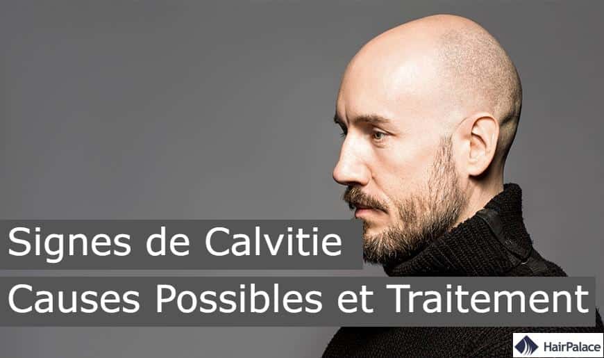 signes de calvitie causes possibles et traitement