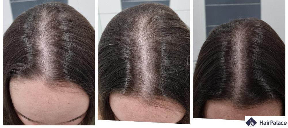 avant et après les cheveux à la biotine