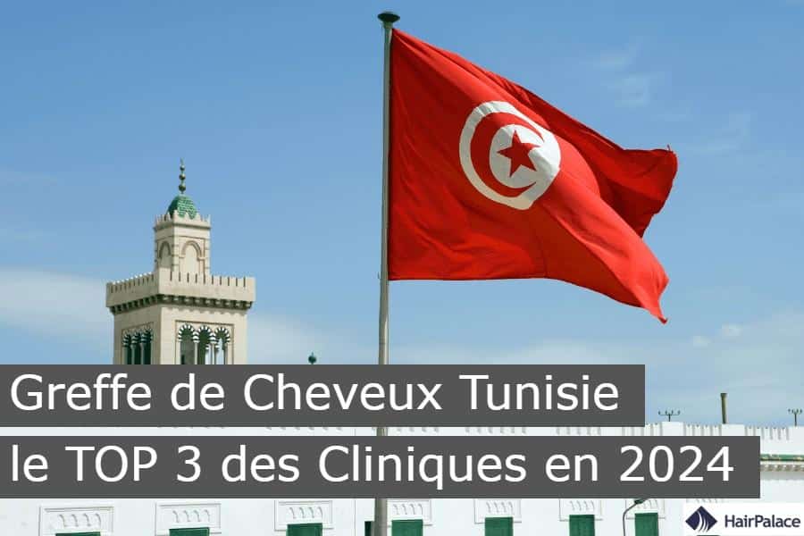 Greffe de Cheveux Tunisie le TOP 3 des Cliniques en 2024