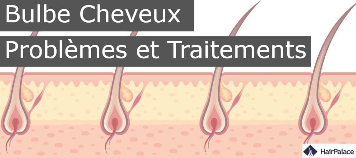 Bulbe Cheveux Problèmes et Traitements